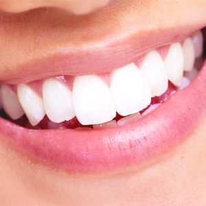 How to maintain your new pearly whites