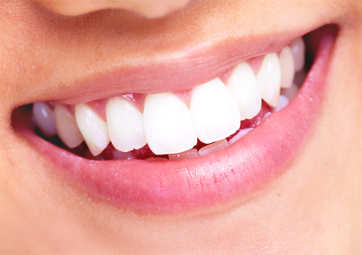How to maintain your new pearly whites
