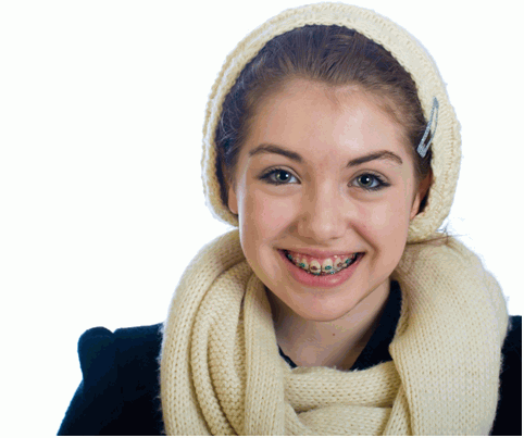 Health Benefits of Straight Teeth