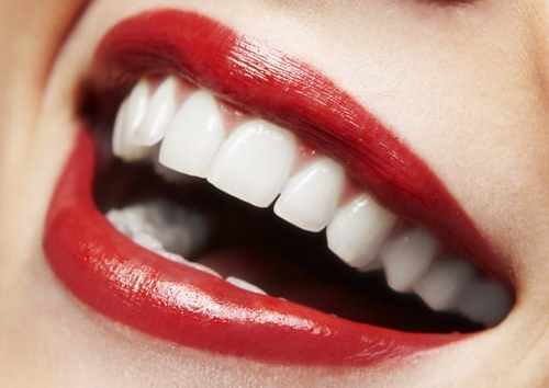How to care for your teeth during holidays
