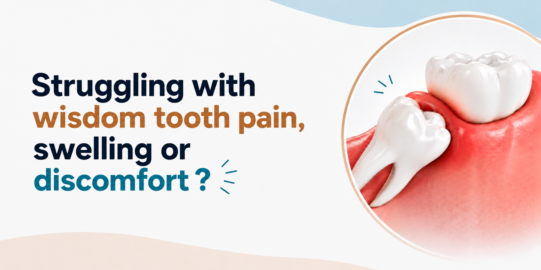 wisdom tooth extraction