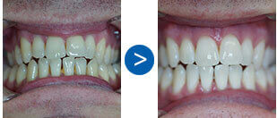 mysmiledoctor_teeth1